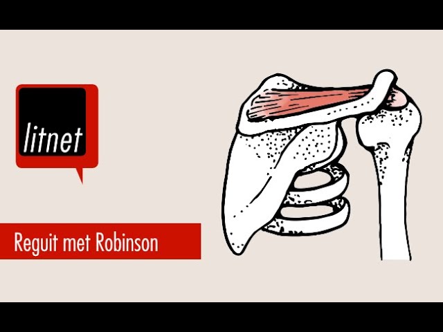 Die kuns en die wetenskap van skouervervangings